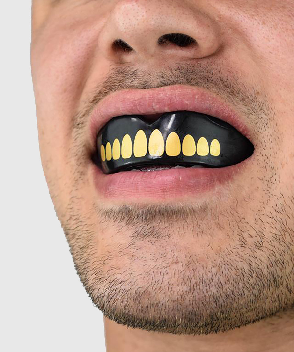 Safejawz Goldie Mouthguard – Adult – Black/Gold