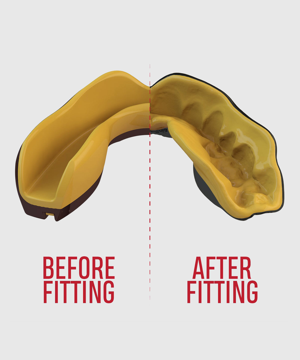 Safejawz Goldie Mouthguard – Adult – Black/Gold